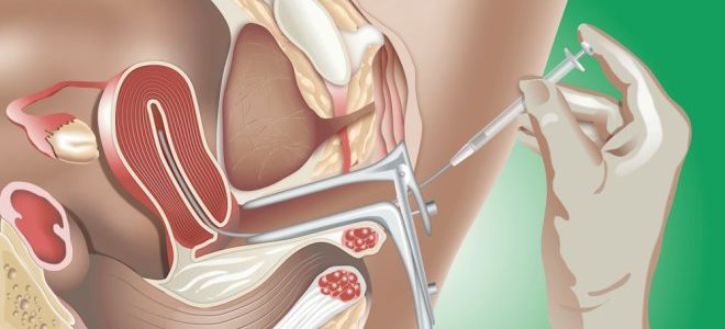 Ikki kishi sochli etuk xotinni sikish
