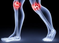 Kramp qo'shimchalari - nima qilish kerak?