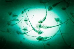 Shlyapalardagi sperma fotosurati