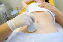 Endometriyning elyaf-tolali poliplari