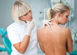 Tug'ilganlik belgisi og'riydi