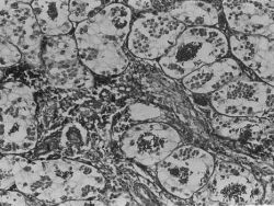 Formadagi seksual harbiy qizlar